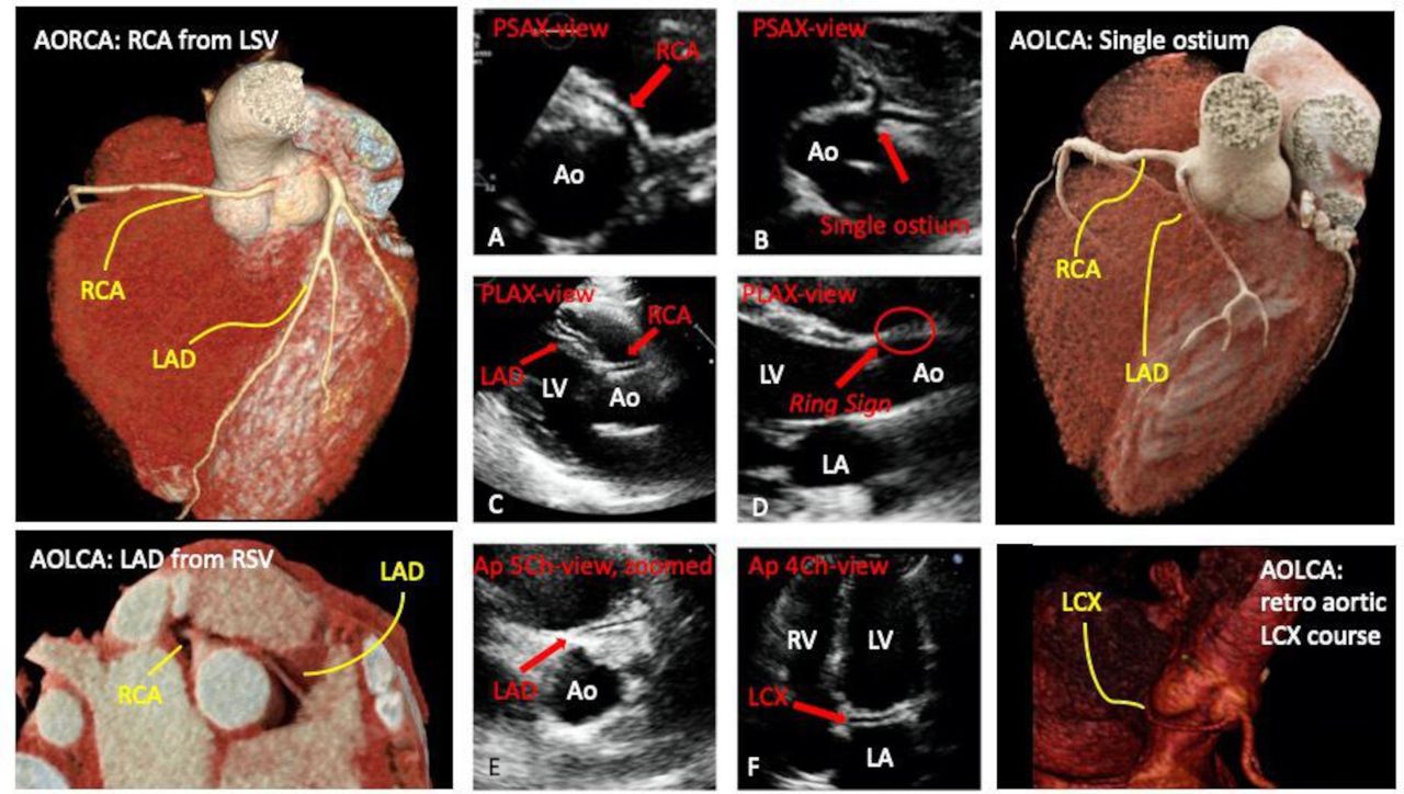 Heart-Anomaly-Image